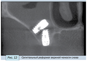 Седов-12.jpg Седов-12.jpg