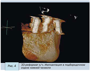 Седов-5.jpg Седов-5.jpg