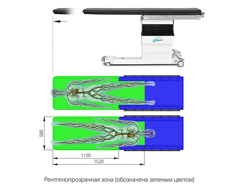 МЕДИН САФИС – стол рентгенохирургический